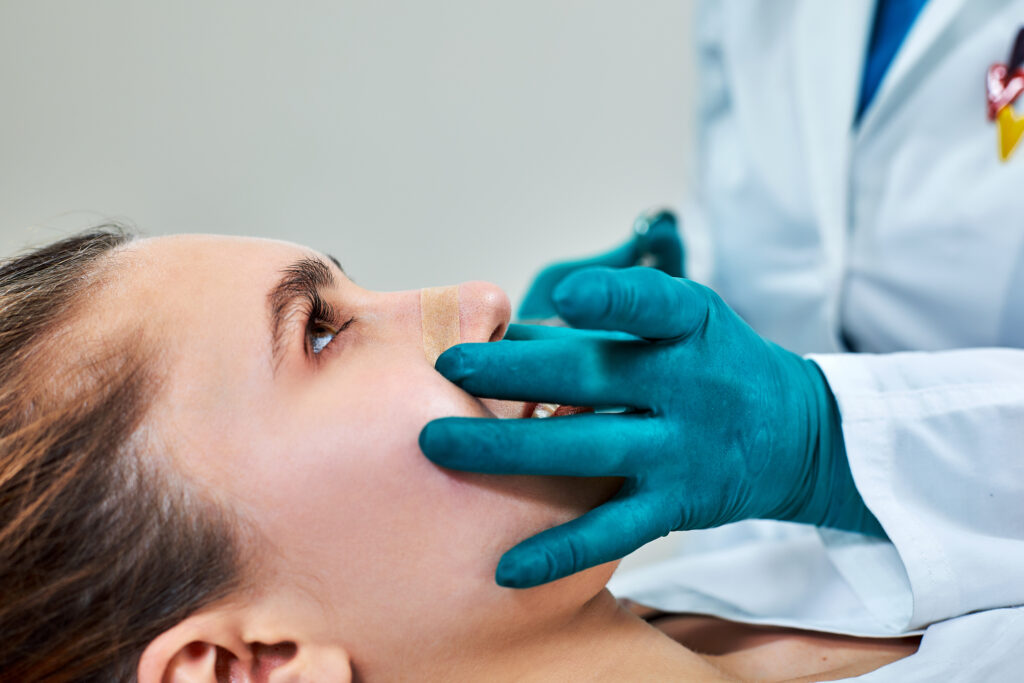 Revision Rhinoplasty Cilento Plastic