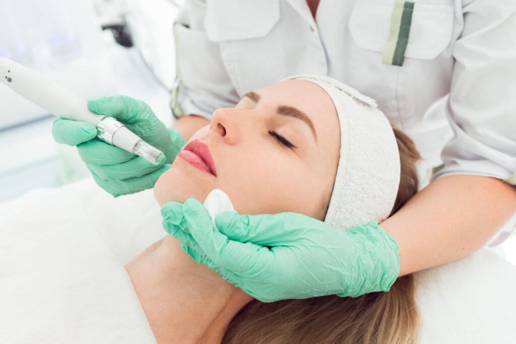 PRP-Microneedling-Treatment.jpg